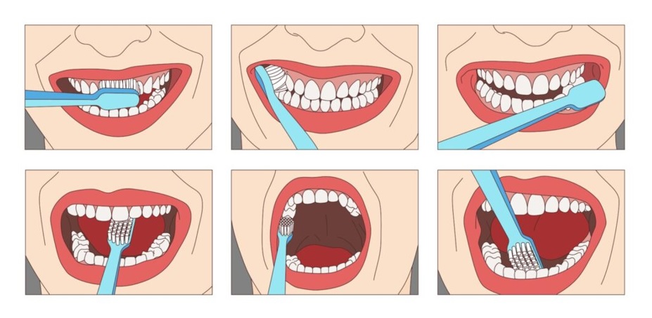техника чистки зубов